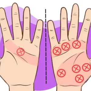 Chữ X Trong Lòng Bàn Tay: Điềm Tốt Hay Xấu?